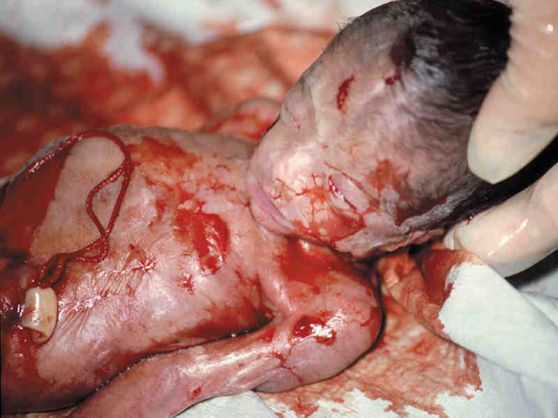 Abortion is murder.