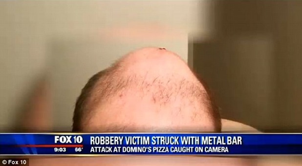 26D6871700000578-3004127-Thompson_said_he_was_lucky_it_was_just_a_metal_bar_that_the_thie-a-1_1426863798020