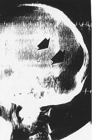 XRAY 2