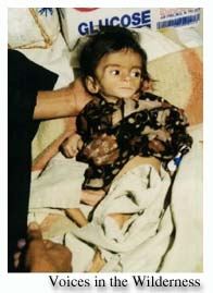 Starving child of Iraq